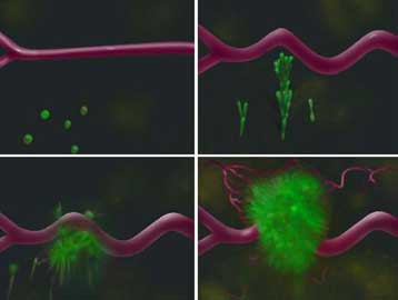 Επιστήμονες εξηγούν πώς συμβαίνει η μετάσταση των καρκινικών κυττάρων