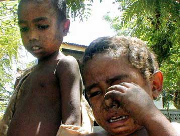 Το 13% του παγκόσμιου πληθυσμού υποσιτίζεται