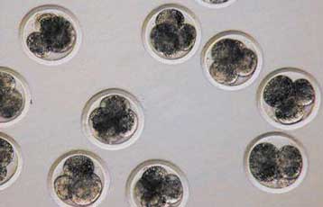 Μεταμόσχευση ιστού ωοθηκών επιτρέπει σε γυναίκες να παράγουν ωάρια… στο χέρι τους