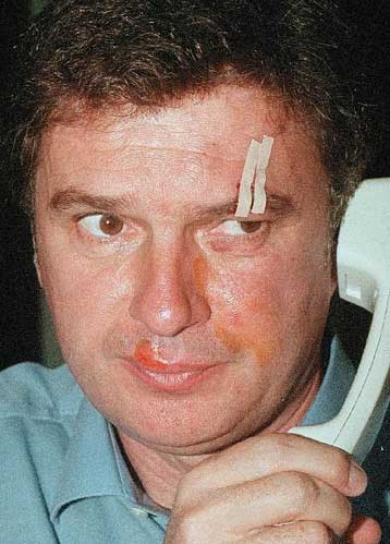 Παραιτείται ο Τουμπάκοβιτς από την Παρτιζάν λόγω των επεισοδίων<I>Δεν αξίζει να δουλέψω για το γ