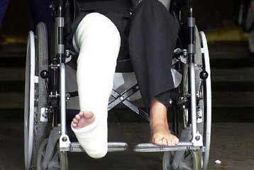 Το βιοενεργό γυαλί συνεργάζεται με το σώμα για την αποκατάσταση των οστών