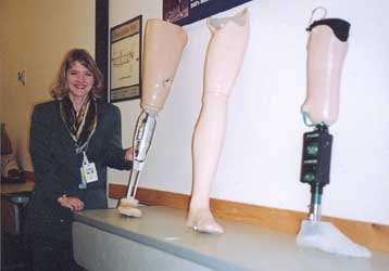 «Έξυπνο» προσθετικό πόδι σχεδιάζεται στις ΗΠΑ από επιστήμονες… πυρηνικών όπλων