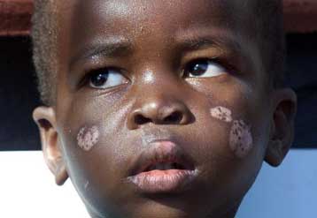 Ο ΟΗΕ προειδοποιεί για το φάσμα της πείνας<i>Τη Δευτέρα η Παγκόσμια Ημέρα Σίτισης</i>