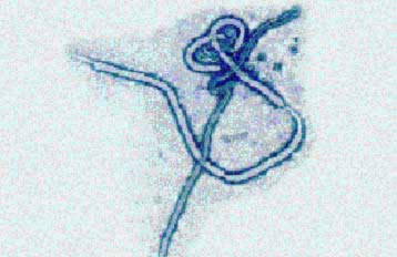 Τουλάχιστον 31 νεκροί στην Ουγκάντα από επιδημία του ιού Έμπολα