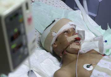 Κλινικά νεκρός 12χρονος Παλαιστίνιος που πυροβολήθηκε από Ισραηλινούς στρατιώτες