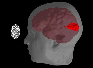 Μαγνητικός τομογράφος «διαβάζει» τη σκέψη