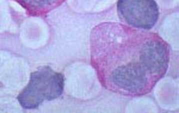 Βλαστοκύτταρα διορθώνουν εκτεταμένες βλάβες στο νωτιαίο μυελό πειραματόζωων