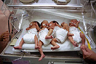 Κατά συνείδηση θα ψηφίσουν οι Βρετανοί βουλευτές για τον κλωνισμό ανθρώπινων εμβρύων