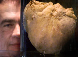 Γενετική θεραπεία για καρδιακή ηρεμία