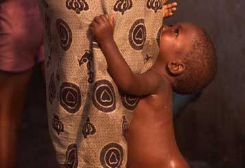 Αντιμέτωποι με την πείνα 28 εκατομμύρια άνθρωποι στην υποσαχάρια Αφρική