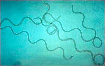 Διατροφικό συμπλήρωμα με κυανοφύκη προστατεύει από ασθένειες