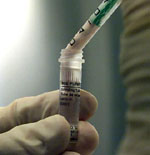 Νέα γενιά ιντερφερόνης βοηθά στην καταπολέμηση της ηπατίτιδας C