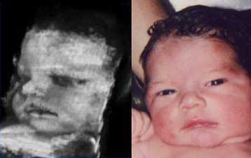 Τρισδιάστατη φωτογραφία του παιδιού σας πρoτού… γεννηθεί