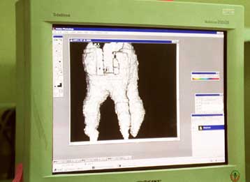 Δισεκατομμύρια για ένα… αστραφτερό χαμόγελο ξοδεύουν οι Έλληνες