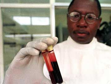 Νέο εμβόλιο για την πρόληψη αλλά και την αντιμετώπιση του AIDS θα δοκιμαστεί στην Ιταλία