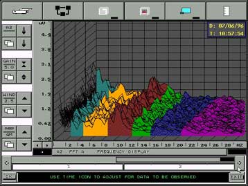 Μέθοδος για την πρόβλεψη των επιληπτικών κρίσεων αναπτύσσεται στη Γαλλία