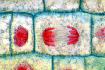 Ένα βήμα πιο κοντά στην αντιμετώπιση των ανθεκτικών καρκινικών όγκων