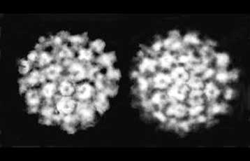 Νέο εμβόλιο για την αντιμετώπιση του καρκίνου στον τράχηλο της μήτρας δοκιμάζεται στη Βρετανία