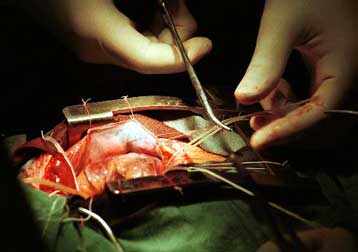 Η πρωτεΐνη των πρωταθλητών μπορεί να βοηθήσει και τη δική σας καρδιά