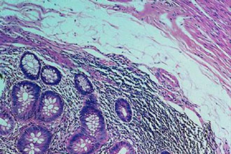 Βρέθηκε το κλειδί του ανοσοποιητικού συστήματος