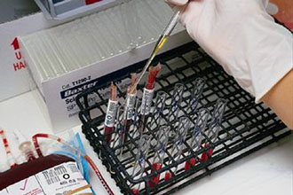 Συμπληρώματα μεταλλικών στοιχείων για καλύτερες αθλητικές επιδόσεις