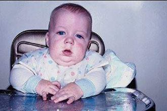 Η πρόωρη διακοπή του θηλασμού βλάπτει τα παιδιά