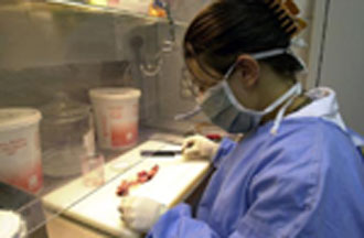 Νέα μέθοδος ανίχνευσης καρκίνου του εντέρου σε πρώιμο στάδιο