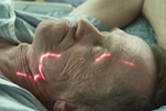 Νέα επαναστατική μέθοδος ακτινοθεραπείας