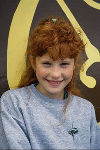 Ακμή: Η αισθητική στην εφηβική ηλικία και… λίγο παραπέρα