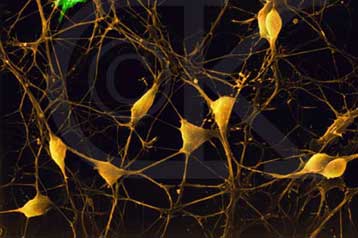 Πειράματα στις ΗΠΑ για τη μελέτη ασθενειών του εγκεφάλου