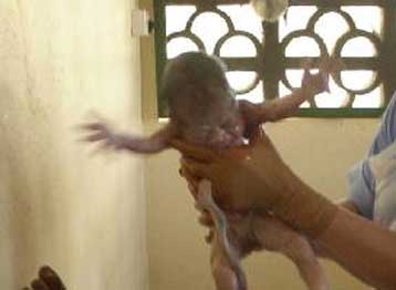 Εναλλακτική λύση στη χρήση εμβρύων;