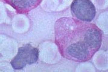 Βλαστικά κύτταρα «επιδιορθώνουν» τον εγκέφαλο ποντικών