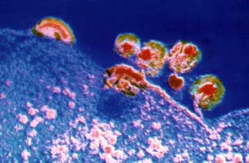 Νέος τύπος του HIV προκαλεί ανησυχία – Θετικός ένας στους δέκα ομοφυλόφιλους σε μεγαλουπόλεις των ΗΠ