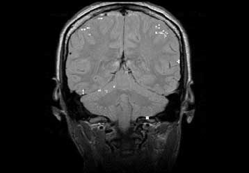 Η προσωπικότητα επηρεάζει την αντίδραση του εγκεφάλου σε εξωτερικά ερεθίσματα, σύμφωνα με έρευνα