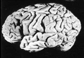 Στο δεξιό προμετωπιαίο λοβό του εγκεφάλου εδρεύει η ικανότητα να κατανοούμε τους άλλους