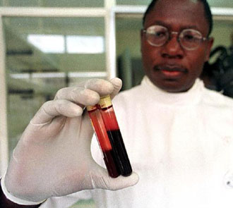 Επικίνδυνα παράγωγα αίματος κυκλοφορούν σε 11 χώρες-Υπόλογο το Λονδίνο