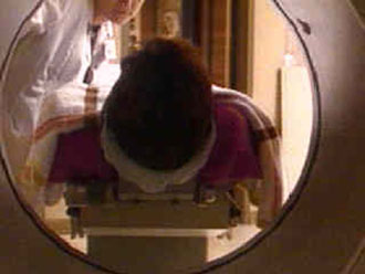 Το 80% των επιληπτικών δεν ακολουθεί καμιά θεραπεία