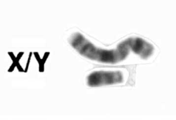 Ορισμένα ανδρικά προβλήματα γονιμότητας κληρονομούνται από τη μητέρα