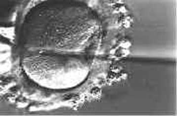 Έλληνας γιατρός βοηθά άνδρες θετικούς στον HIV να τεκνοποιήσουν