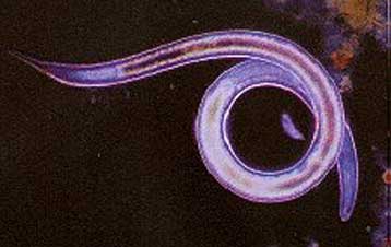 Γενετική τροποποίηση επιβραδύνει τη γήρανση σε σκουλήκια, πιθανώς και σε θηλαστικά