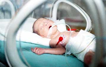 Θλιβερή πρωτιά της χώρας μας στη θνησιμότητα βρεφών