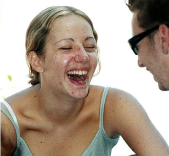 Νέοι και παχυσαρκία: Oι έφηβοι συχνά απεχθάνονται το σώμα τους, σύμφωνα με έρευνα