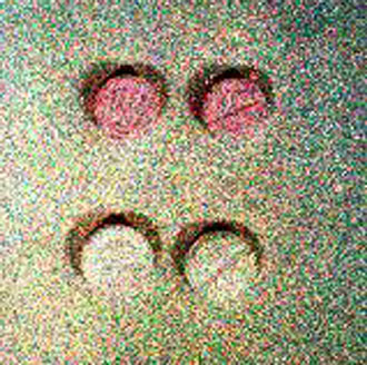 Το Ecstasy προκαλεί απώλεια μνήμης