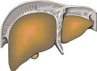 Παράλληλη αύξηση ηπατίτιδας Β και καρκίνου του ήπατος στην Ελλάδα