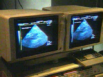 Νέες τεχνικές για την έγκαιρη διάγνωση του καρκίνου του μαστού