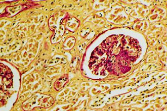 Παρατηρώντας το ταξίδι των αντικαρκινικών φαρμάκων στο σώμα…