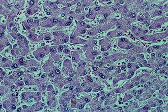 Ενδείξεις λοιμώδους αιτιολογίας της λευχαιμίας