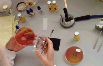 Χαρτογραφήθηκε στην Ιαπωνία το γονιδίωμα επικίνδυνων βακτηρίων