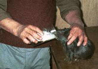 Φάρμακο για διαβητικούς αναστέλλει τον καρκίνο του παγκρέατος