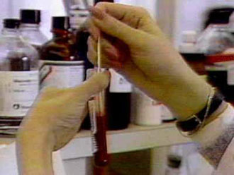 HIV για τη θεραπεία του καρκίνου;